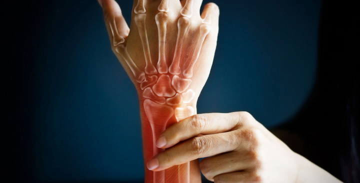 How to improve your bone health?